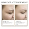 Side-by-side before and after comparison of a woman's skin showing reduced fine lines and improved hydration after skincare treatment.