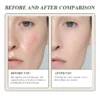 Side-by-side images showing a skincare treatment result: before with dull skin and fine lines, after with firmer, radiant skin.
