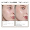 Before-and-after image showing skin transformation with reduced fine lines, improved hydration, and a smoother texture.
