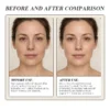 Side-by-side comparison of a woman's face before and after using a skincare product, showing visible improvement in skin texture and brightness.