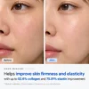 Close-up side-by-side comparison showing skin texture before and after using a skincare product, highlighting improved firmness and elasticity.